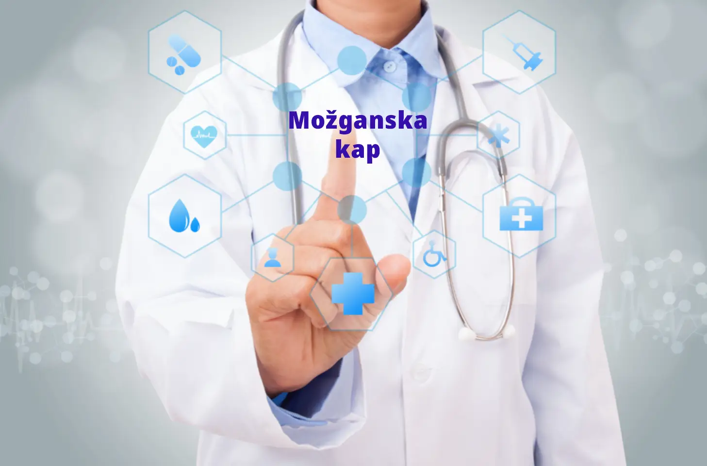 znaki možganske kapi