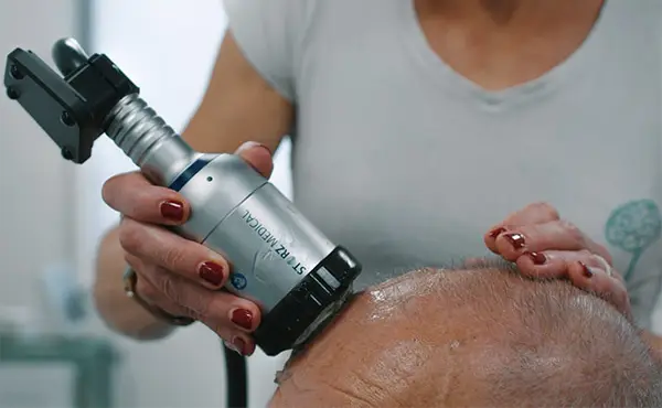 Transkranialna pulzna stimulacija (TPS) pri pacientu – sodoben pristop k zdravljenju nespečnosti in nevroloških motenj